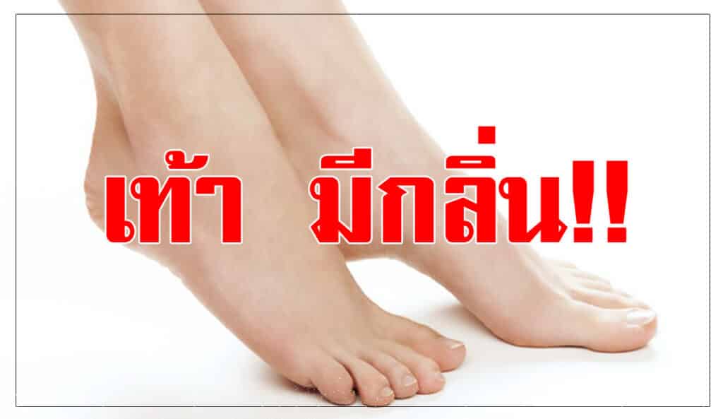 เท้ามีกลิ่น