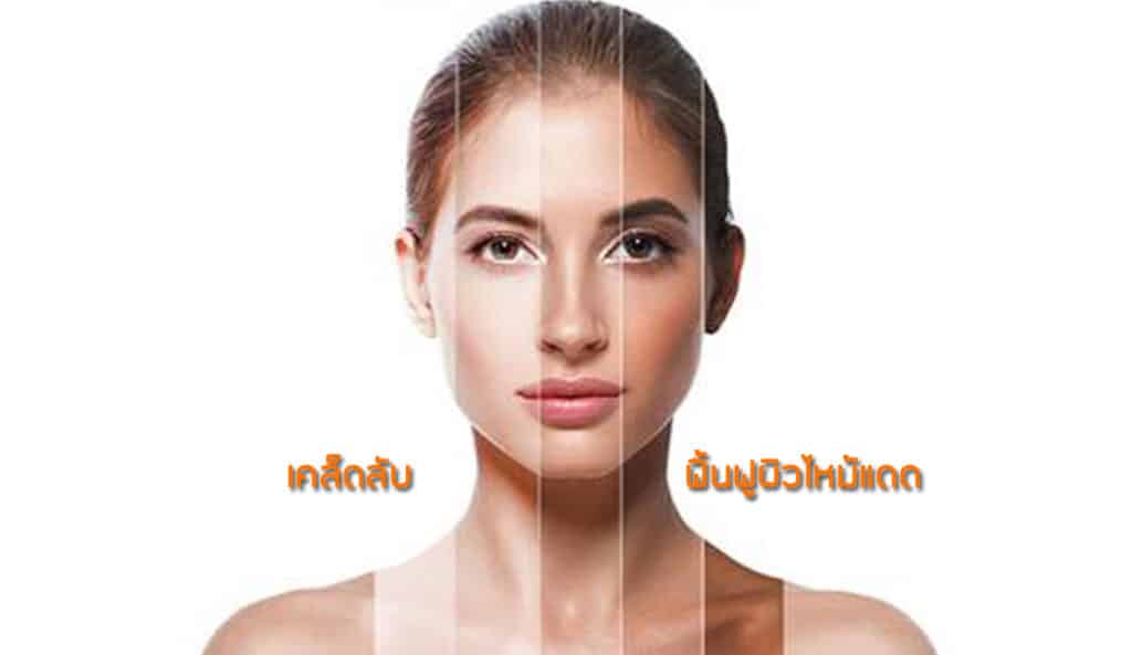 เคล็ดลับฟื้นฟูผิวไหม้แดด