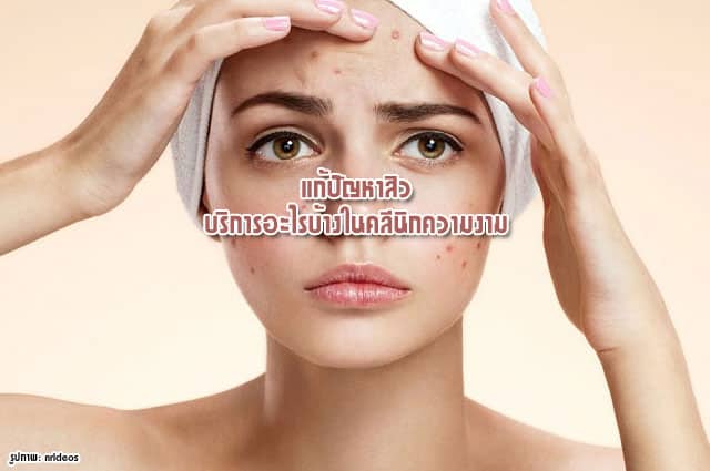 acne ลดสิว เป็นสิว รักษาสิว
