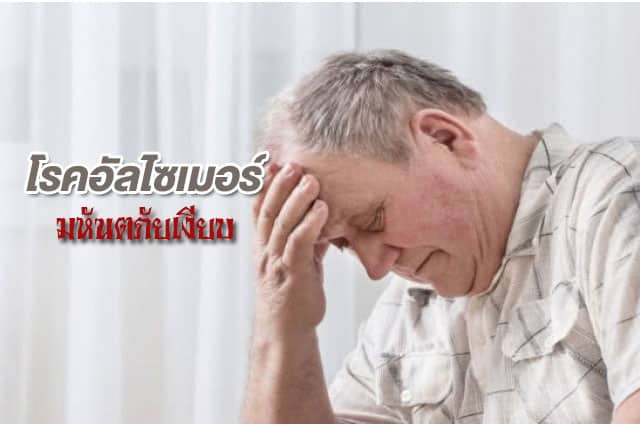 โรคความจำเสื่อม การดูแลรักษา